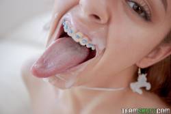 Vanna-Bardot-Oral-Orthodontics-242-pics-1620x1080--06wux1axho.jpg