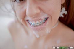 Vanna-Bardot-Oral-Orthodontics-242-pics-1620x1080--t6wux0rkwx.jpg