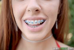 Vanna-Bardot-Oral-Orthodontics-242-pics-1620x1080--d6wuxfexo2.jpg