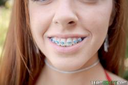 Vanna-Bardot-Oral-Orthodontics-242-pics-1620x1080--76wuxfd0ov.jpg