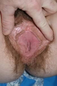 Amateurs playing doctor (x70) y7b9rnxm4h