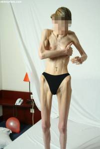 EXTREME Skinny Anorexic Janine 1-07btsg3feu.jpg