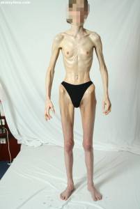 EXTREME Skinny Anorexic Janine 1 57btshf4xu