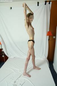 EXTREME Skinny Anorexic Janine 1 f7btshg664