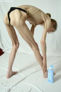 EXTREME Skinny Anorexic Janine 1 d7btsgwlu5