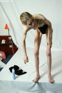 EXTREME Skinny Anorexic Janine 1 g7btsfu5vs