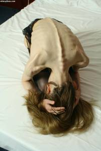 EXTREME Skinny Anorexic Janine 1 f7btsfb2z6