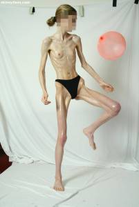 EXTREME Skinny Anorexic Janine 1 47btsin0py