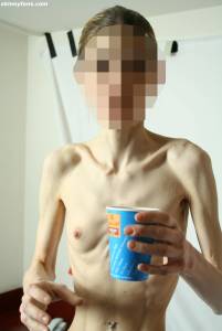 EXTREME Skinny Anorexic Janine 1 p7btsfw7sw