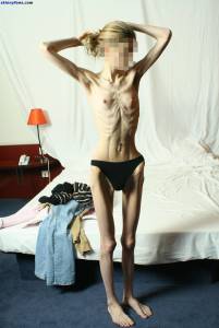 EXTREME Skinny Anorexic Janine 1 a7btsboll6