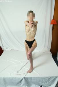 EXTREME Skinny Anorexic Janine 1 p7btshuhxl