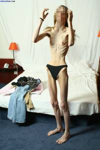 EXTREME Skinny Anorexic Janine 1 q7btsbtyf0