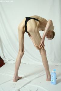 EXTREME Skinny Anorexic Janine 1 k7btshbg2o
