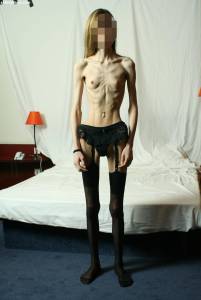 EXTREME Skinny Anorexic Janine 1 n7btsdgyqn