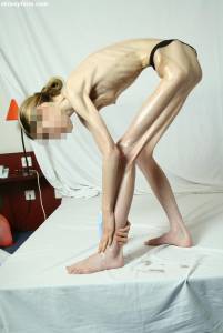 EXTREME Skinny Anorexic Janine 1 q7btsgr01t