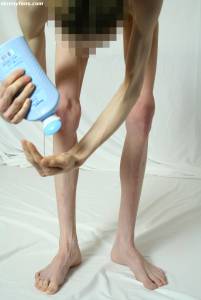 EXTREME Skinny Anorexic Janine 1 z7btsg6k5u