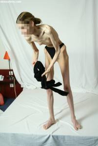 EXTREME Skinny Anorexic Janine 1-z7btsfq1gn.jpg