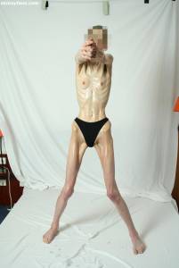 EXTREME Skinny Anorexic Janine 1-u7btshxkx4.jpg