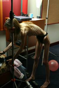 EXTREME Skinny Anorexic Janine 1 b7btsciswb