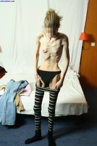 EXTREME Skinny Anorexic Janine 1 s7btsb27lk