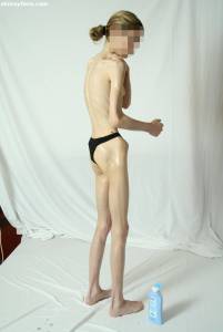 EXTREME Skinny Anorexic Janine 1 p7btshd6lo