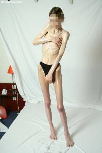 EXTREME Skinny Anorexic Janine 1 u7btshjqwz