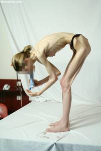 EXTREME Skinny Anorexic Janine 1 t7btsgohkb
