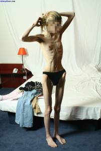 EXTREME Skinny Anorexic Janine 1-47btsbpnvb.jpg