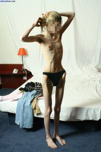 EXTREME Skinny Anorexic Janine 1 47btsbpnvb