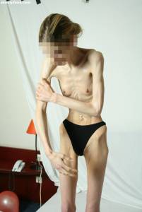 EXTREME Skinny Anorexic Janine 1 g7btsg0fl3