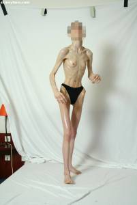 EXTREME Skinny Anorexic Janine 1 t7btsila0v