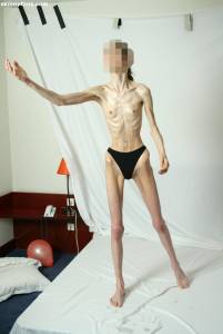 EXTREME Skinny Anorexic Janine 1 b7btsigpfz