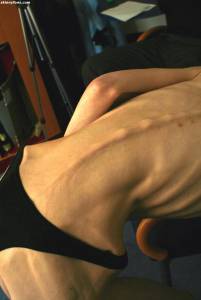 EXTREME Skinny Anorexic Janine 1 u7btscbd0x