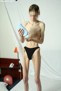 EXTREME Skinny Anorexic Janine 1 d7btsgbieq