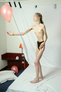 EXTREME Skinny Anorexic Janine 1 27btsidfch