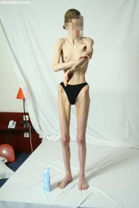EXTREME Skinny Anorexic Janine 1 n7btsgdhj6
