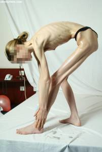 EXTREME Skinny Anorexic Janine 1-g7btsgqlrs.jpg