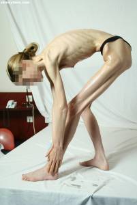 EXTREME Skinny Anorexic Janine 1 g7btsgqlrs