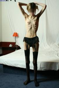 EXTREME Skinny Anorexic Janine 1 e7btsdegpd