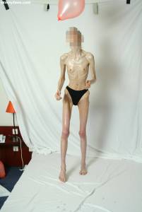 EXTREME Skinny Anorexic Janine 1-o7btsi03y4.jpg