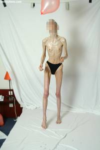 EXTREME Skinny Anorexic Janine 1 o7btsi03y4