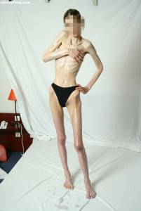 EXTREME Skinny Anorexic Janine 1 c7btshla4r
