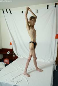 EXTREME Skinny Anorexic Janine 1-47btshighs.jpg