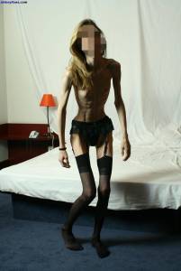 EXTREME Skinny Anorexic Janine 1 a7btsd23nr
