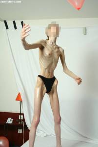 EXTREME Skinny Anorexic Janine 1 p7btsi60ps