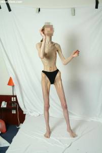 EXTREME Skinny Anorexic Janine 1 i7btsi1z4k
