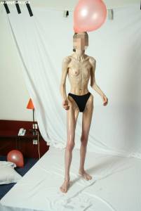 EXTREME-Skinny-Anorexic-Janine-1-f7btsihkic.jpg