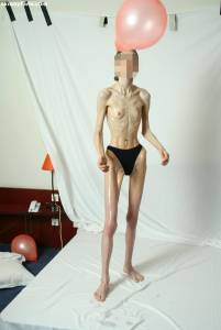 EXTREME Skinny Anorexic Janine 1 f7btsihkic