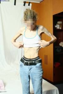 EXTREME Skinny Anorexic Janine 1 z7btsba77p
