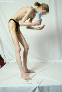 EXTREME Skinny Anorexic Janine 1-j7btsgtljn.jpg